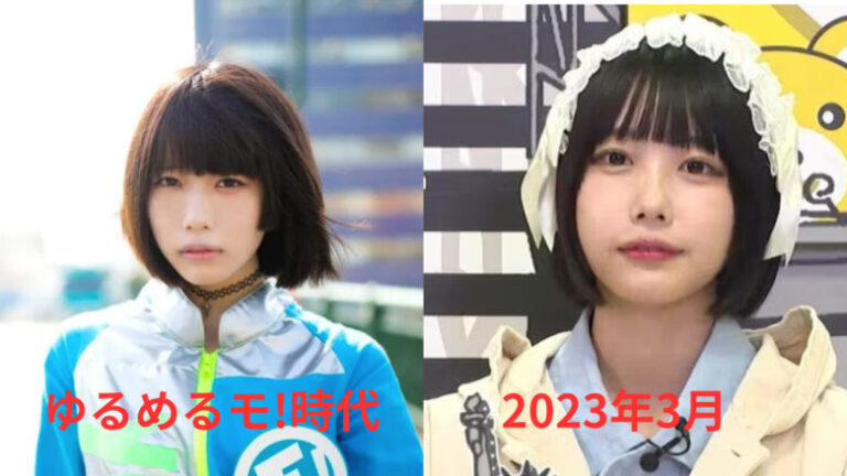 あのちゃんは整形してる?ゆるめるモ時代と画像比較!唇や口角が前と違う? - 井戸端ブログ